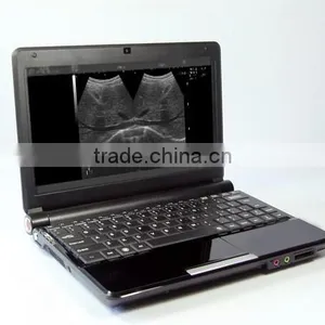 Affordable Laptop Portable Ultrasound Scanner Manufacturer thumbnail-6