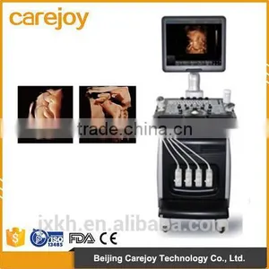 CE ISO Approved Medical 15 Inch LCD Monitor 3D 4D Trolley Color Doppler Ultrasound Scanner thumbnail-1