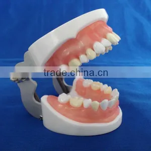 Typodent Dental Jaw Model for Practice Extract Tooth thumbnail-3