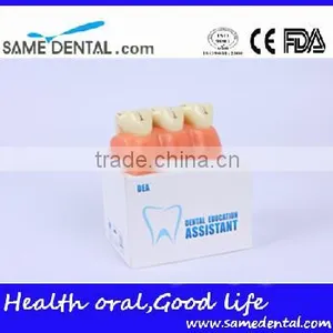 4 Times the Cavities Progress Model Dental Eduction Assitant No. DEA-16 thumbnail-5