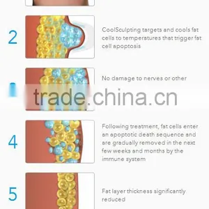 Cool Sculpting Cellulite Reduction !!!! 5 Handles Cryolipolysis Fat Freezing Slimming Best Cryolipolysis Machine Body Contouring thumbnail-6