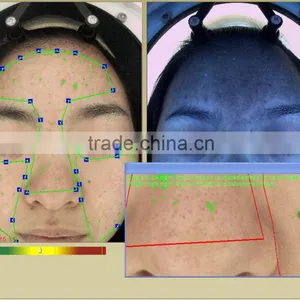 Auto Facial Skin Portable Analyzer With Customer Datebase and 10 Mega Pixels Camera thumbnail-6