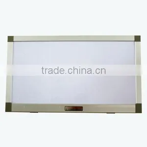 High Quality LED Medical X-ray Film Viewer Negatoscope thumbnail-1