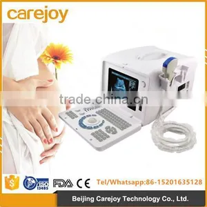 CE ISO Approved Full Digital Imaging Technology 10-inch Monitor 2 Probe Connector Usb pc Based Ultrasound Scanner China thumbnail-1