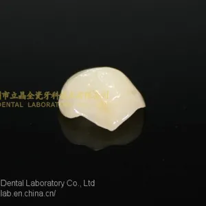 Dental Crown E.Max Ceramic, Porcelain Crown, Dental Veneers, Laboratoire Dentaire, Dentallabor, Laboratorio Dental, Dental Laboratory, Shenzhen LJ Dental Lab China thumbnail-4