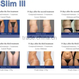 Best Selling Products VelaSlim Skin Tightening Radio Frequency Machine thumbnail-2