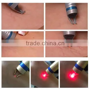 Spiritlaser High Quality Beauty Salon Use 980nm Laser Pointer for Vascular Removal thumbnail-5