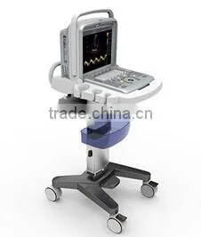 CE Approved Portable Color Ultrasound Scanner With Optional 4D Function( Q9) thumbnail-2