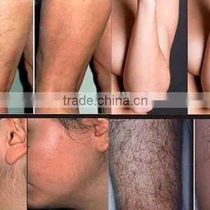 Hair Removal and Skin Rejuvenation Beauty Device With 2 Lamps Under Medical CE thumbnail-3