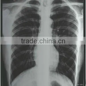 Agfa Hns Film, Agfa Film Dt2b of Medical Equipment Wholesale thumbnail-1