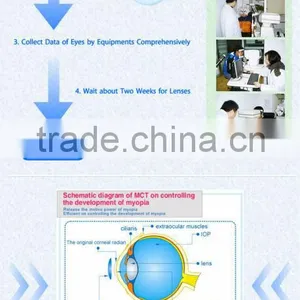 High-technology Mild MCT ,fpr Myopia and Amblyopia China thumbnail-1