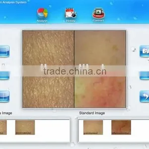 2014 New Designed Handheld Skin Analyze Camera thumbnail-4
