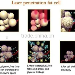Medical CE ISO 13485 Machine/ Laser Slimming Machine for Fat Reducing thumbnail-5