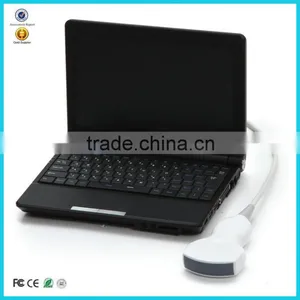 CE Hot Sale Portable Laptop Ultrasound Scanner/Machine Hospital Clinic Diagnosis With Probe/Transducer and Printer thumbnail-1