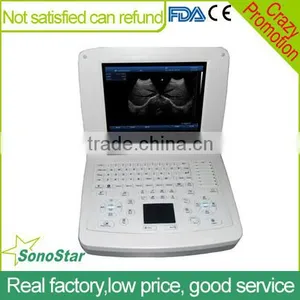 Sonostar Good Quality Handheld Portable Vet Ultrasound Scanner Pig Veterinary Ultrasound V10(SS-10V ) thumbnail-1