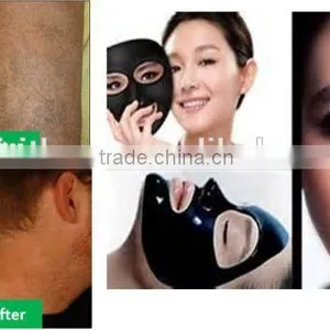 Good Portable Beauty Equipment Yag Laser Tattoo Removal Lasers thumbnail-3