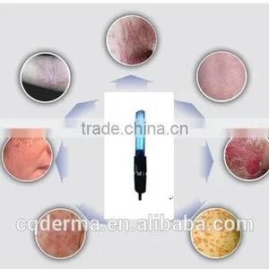 Home Use Portable UV Phototherapy 311nm Narrow Band Uvb Lamp for Psoriasis Treatment Vitiligo Treatment thumbnail-5