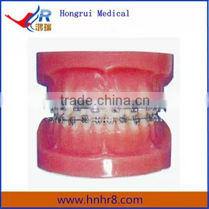 Hot Sale Medical Teeth Fixed Orthodontic Model (Normal) thumbnail-1