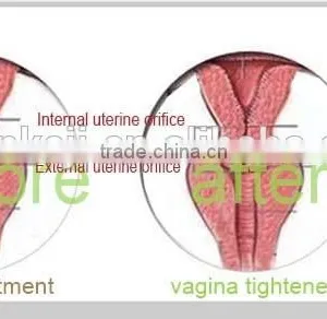 15W(20W) Fractional CO2 Laser Machine Surgical Treatment 8.0 Inch Vaginal Tightening Better Than Vaginal Lubricants thumbnail-5