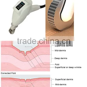 Remove Pigmentation Machine Innovative Products For Import Missface-80 thumbnail-1