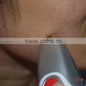 Reduction of Wrinkle, Dark Color, Puffy Skin Remage Device thumbnail-5
