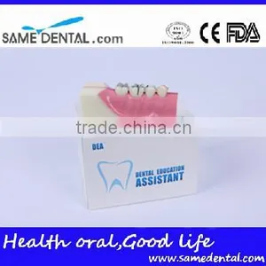 Right Tooth Tissue Decomposition Model Dental Eduction Assitant No. DEA-17 thumbnail-4
