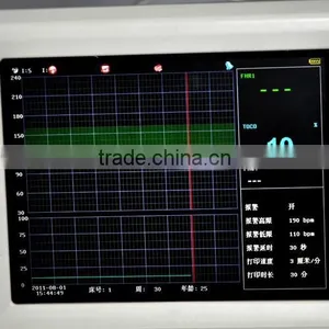 24 Hour Real-time Monitoring Prenatal Fetal Monitor TOCO FHR Fetal Move Optional Extra Ultrasonic Transducer thumbnail-4