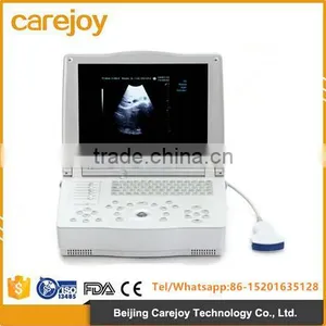 2016 New 15-inch Laptop Ultrasound Scanner With Low Price thumbnail-1