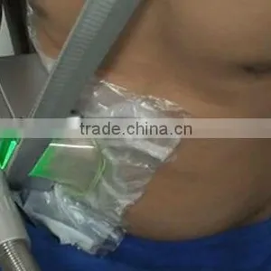 Cryotherapy Anti Freeze Membrane thumbnail-4