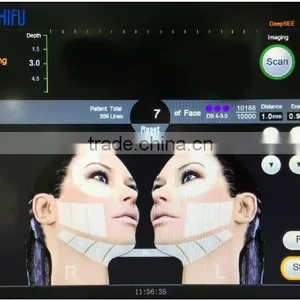 2016 High Intensity Focused Ultrasound Hifu/facelifting Hifu thumbnail-5