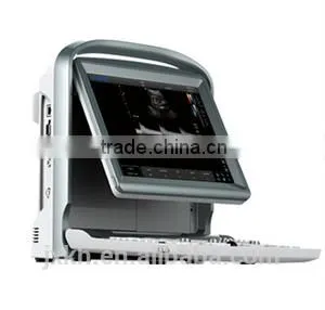 2016 NEW Ultrasound Scanner Color Doppler thumbnail-5