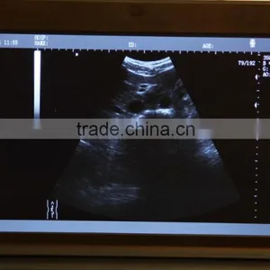 10 Inch Ultrasonic B Laptop Ultrasound Machine/Scanner RUS-9000F With Battery by CE ISO Approved thumbnail-4