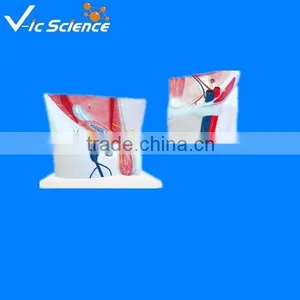 Inguinal Model Teaching Groin Anatomy Plastic Model thumbnail-1
