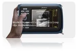 Handheld Ultrasound Scanner for Family Doctors, Clinic and Hospital thumbnail-3