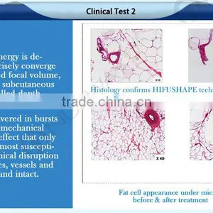 CE / FDA Approved High Effective HIFU Shape Body Slimming Machine Far Infrared Slimming Pressotherapy Machine thumbnail-3