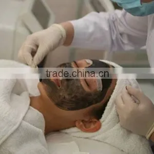 2015 Chrismas Promotion USd1200!! ND Yag Laser Tattoo Remover Portable / Mini Home Use Tattoo Removal nd Yag Laser thumbnail-4