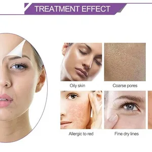 Hydro-oxygen Machine Spray Beauty Device With 5 Spray Modes for Skincare Spa thumbnail-3