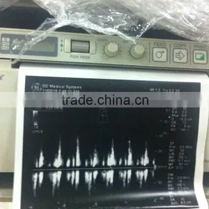 Sony Printing Paper UPS-110S for Ultrasound Printer thumbnail-2