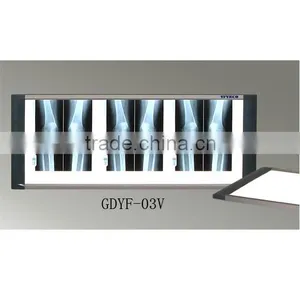 X Ray Film Viewer for the Hospital Useful thumbnail-1