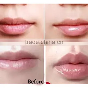 Famous Brand Round Cute Shape Sweet Scented Lip Balm thumbnail-2
