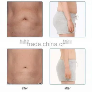 Best Selling Products 2016 Cool Tech Fat Freezing Slimming Machine thumbnail-6