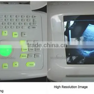 CE Approved Digital Portable Ultrasound Scanner With Multi Frequency Probe Machine thumbnail-3