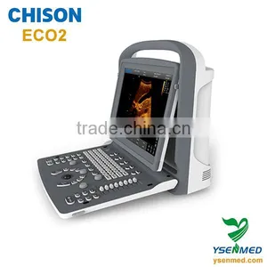 ECO2 High Image Quality Good Price Black and White Portable Ultrasound Chison thumbnail-2