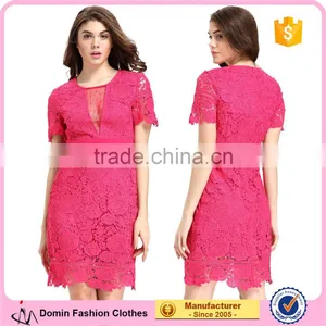 Fashion Lace Patchwork Short Frock Lady Image Skater Dress thumbnail-1