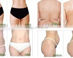 Body Slimming Body Shape Beauty Equipment thumbnail-2