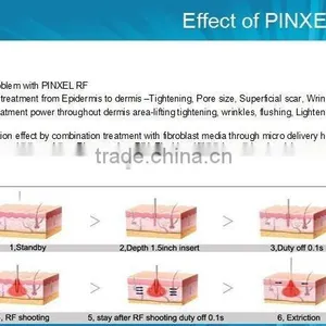 2016 Excellent Portable Fractional rf and Micro Needle Machine for Clinic,beauty Spa thumbnail-3