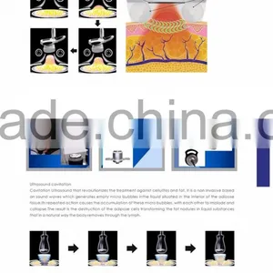 Osano Best Way To Lose Belly Fat Vacuum Suction Machine thumbnail-6