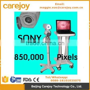 New Video Electronic Colposcope RCS-500 SONY Camera CCD 800,000 Pixels With Software thumbnail-1