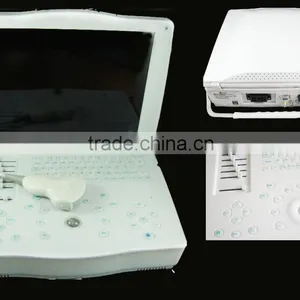 CE Approved Portable Ultrasound Scanner With 3.5Mhz Multi-frequency Convex Probe RUS-9000E thumbnail-1
