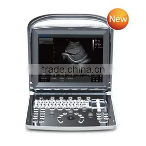 Good Performance Ultrasound Scanner Optional Probe Foot Switch Video Printer thumbnail-1